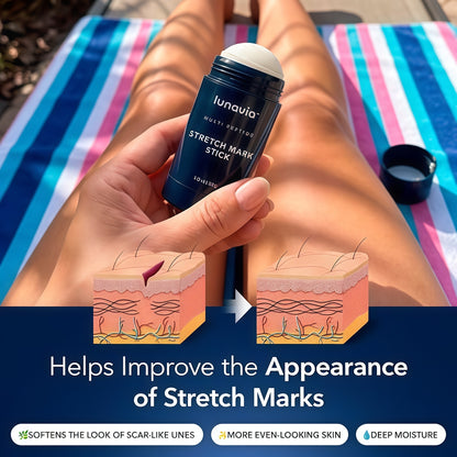 Lunavia Stretch Mark Stick - Bakuchiol, Encapsulated Retinol & Peptides - Nourishing Balm to Help Improve the Appearance of Stretch Marks & Scar-Like Lines